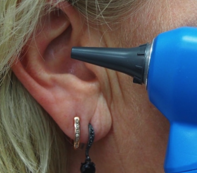 Ear Wax Removal